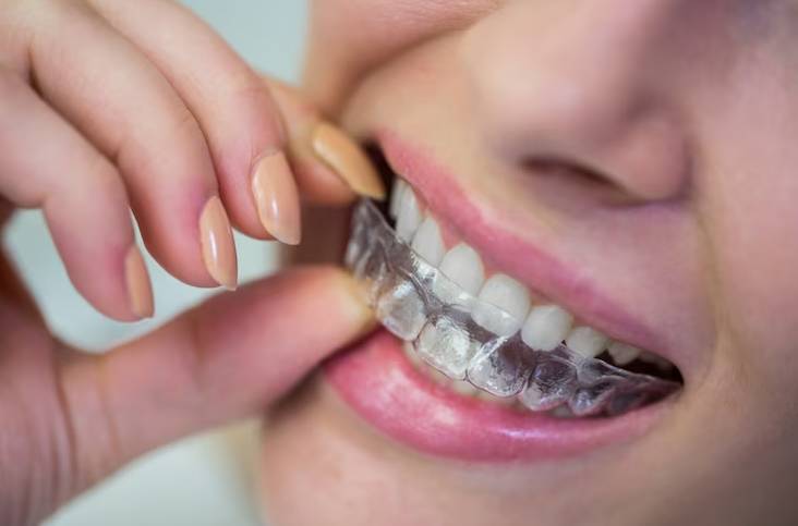 ORTHODONTICS Invisalign Wallaceburg