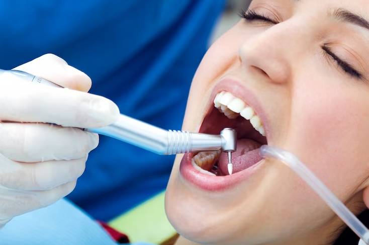 Dental Teeth Cleaning Wallaceburg Dental Teeth Cleaning Wallaceburg